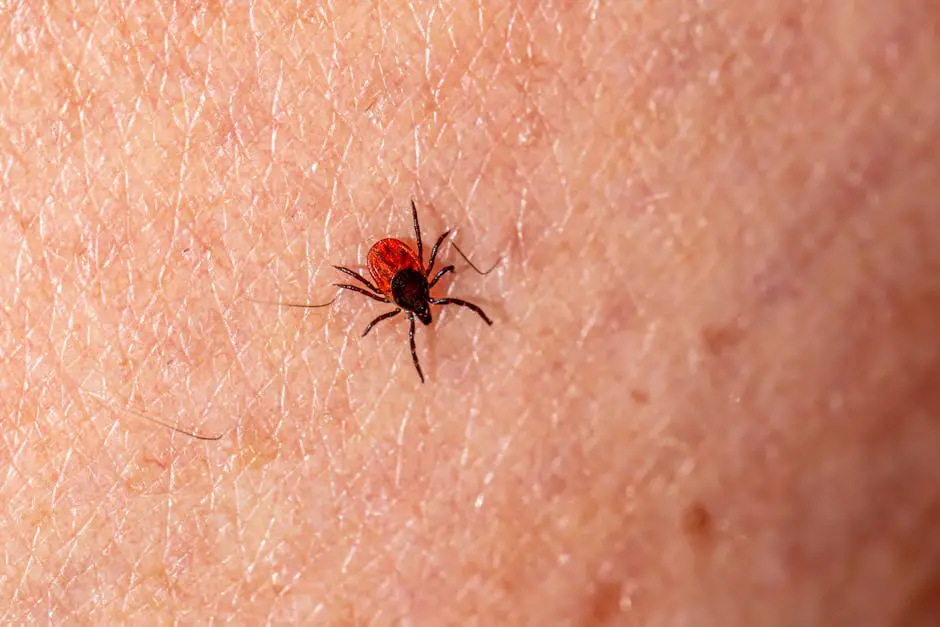 Macro photograph showing a deer tick (Ixodes scapularis) on human skin, highlighting pest detail.